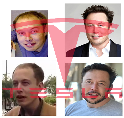 Elon musk online hair loss